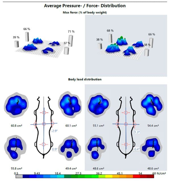 Pressure-distribution-diagram